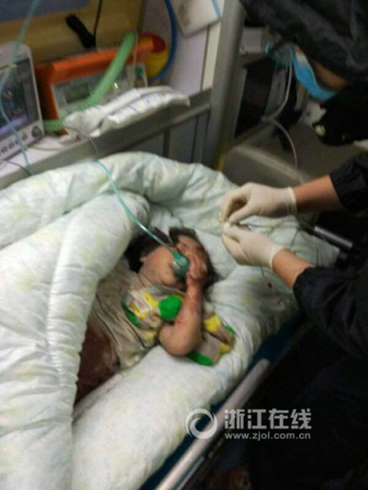 小女孩在醫(yī)院接受治療。