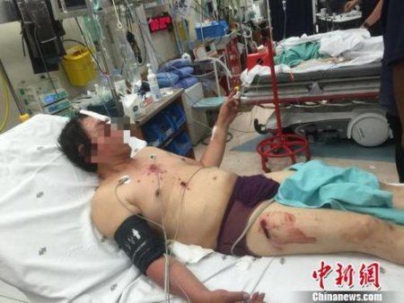 來(lái)自廣西柳州的受傷男子。鐘欣 攝