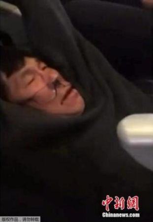 圖為遭受美聯航暴力驅趕的亞裔乘客。