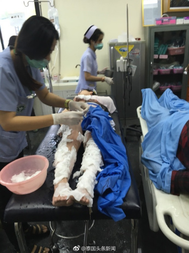 泰國皮皮島附近一快艇突發(fā)爆炸，多名中國人受傷(圖：泰國頭條新聞微博)