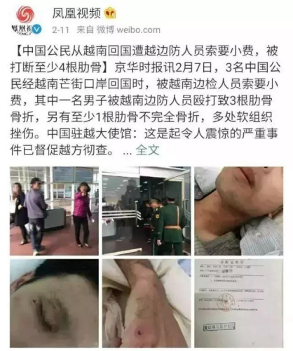 中國公民被越南邊檢人員索要小費(fèi)不成被毆打致骨折 新聞來源：鳳凰視頻