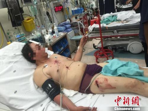 中國(guó)僑網(wǎng)來(lái)自廣西柳州的受傷男子。鐘欣 攝